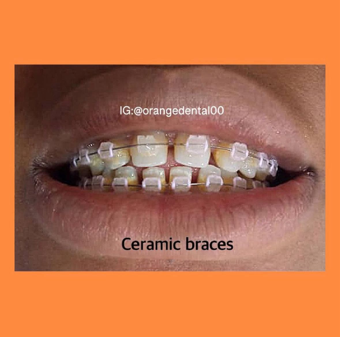 WhatsApp Image 2025-11-10 at 6.03.03 PM