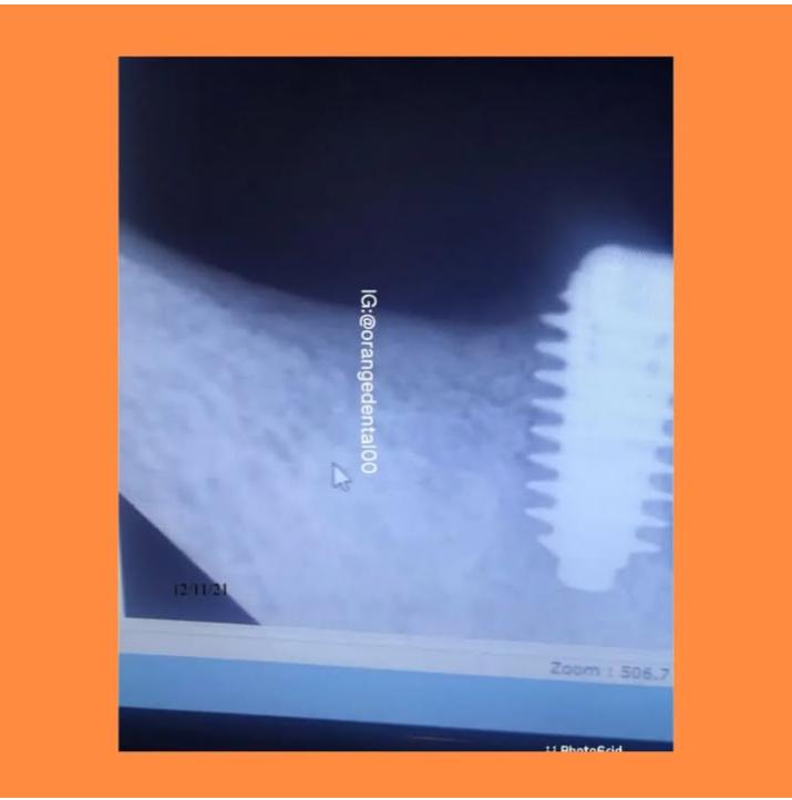 WhatsApp Image 2025-11-12 at 2.05.36 PM